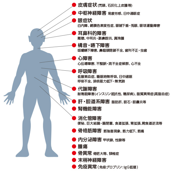 筋強直性ジストロフィーの多臓器障害