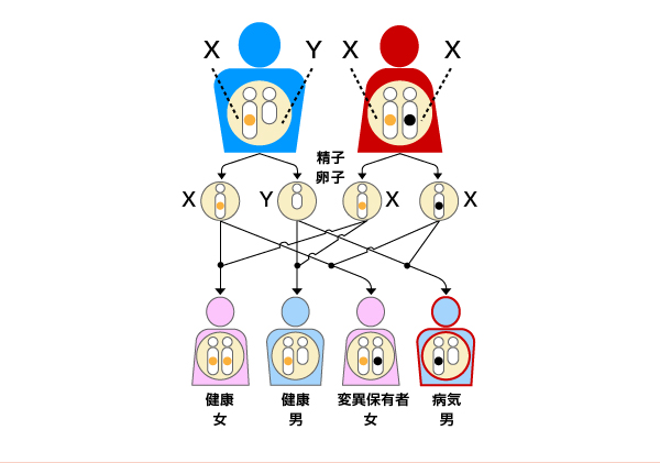 X染色体連鎖遺伝形式
